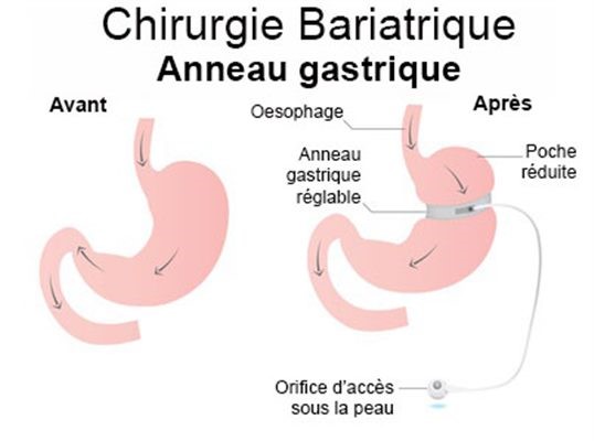 Chirurgie